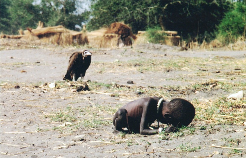 sudan-starving-child