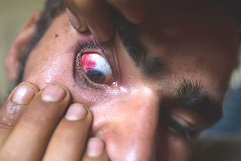 30-indian-brutalities-in-kashmir-2016